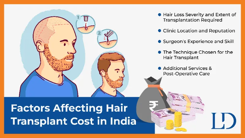 Exploring the Advantages of Hair Transplant