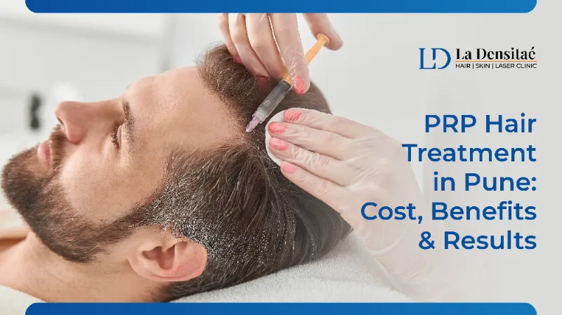 PRP Hair Treatment in Pune