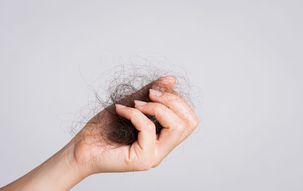 Woman hand holding hair loss on gray background. Health care and