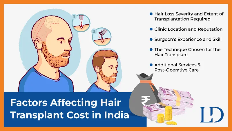 Factors Affecting Hair Transplant Cost in India
