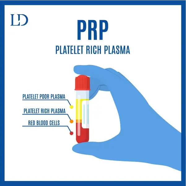 Platelet-rich plasma (PRP) therapy