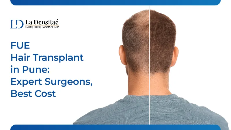 FUE Hair Transplant in Pune