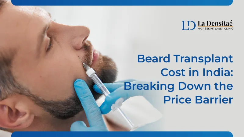 Beard Transplant Cost in India