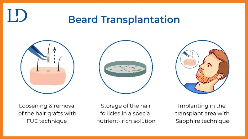 Understanding Beard Transplants