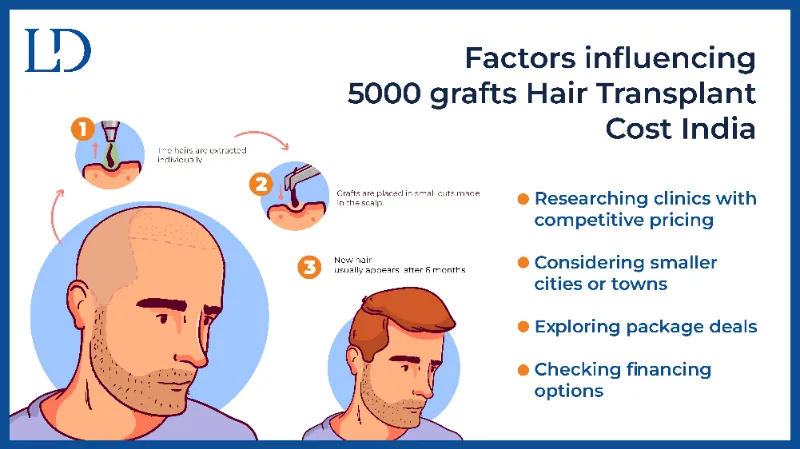 Factors Affecting 500 Grafts Hair Transplant Cost India