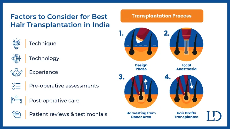 Factors to Consider for Best Hair Transplantation in India
