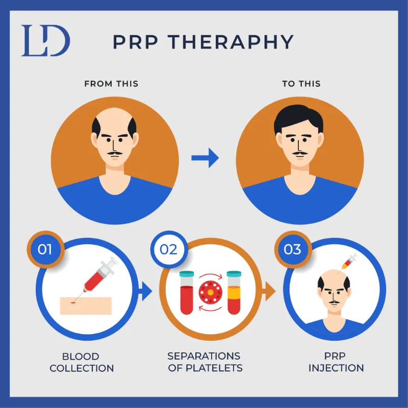 PRP Treatment