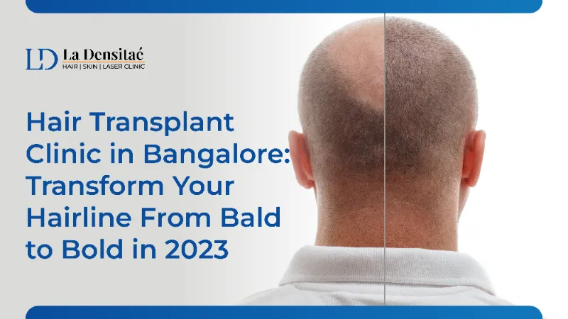 Hair Transplant Clinic in Bangalore