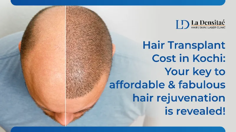 hair transplant cost in kochi