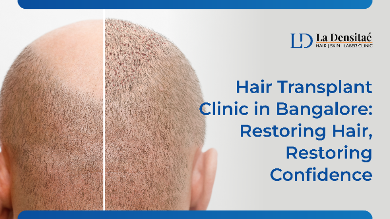 Best Hair Transplant Clinic In Bangalore