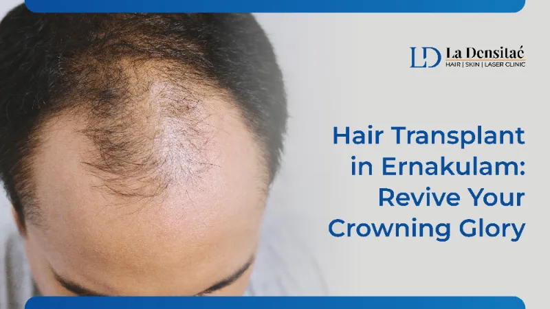 hair transplant in ernakulam