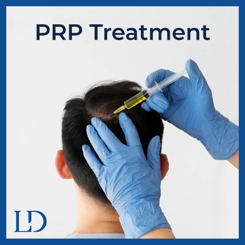 Platelet-Rich Plasma (PRP) hair treatment