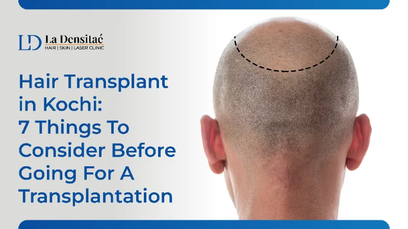 best hair transplant in kochi