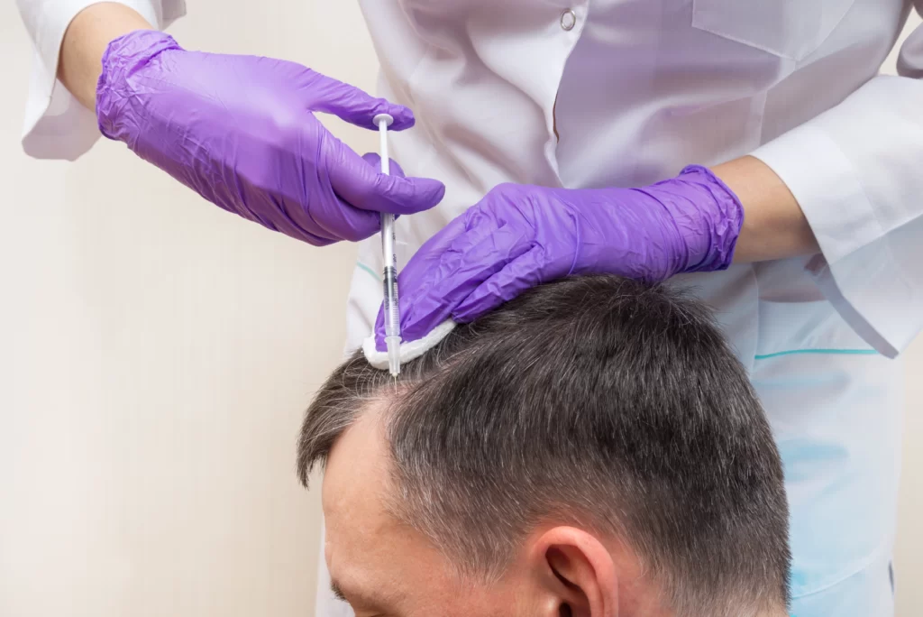 injection treatment hair loss